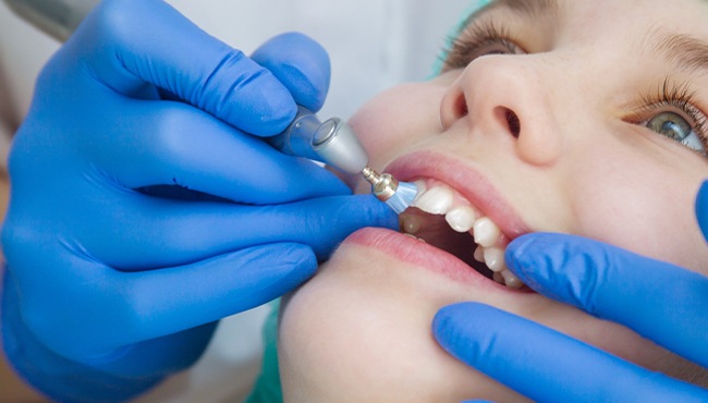 child getting fluoride treatment