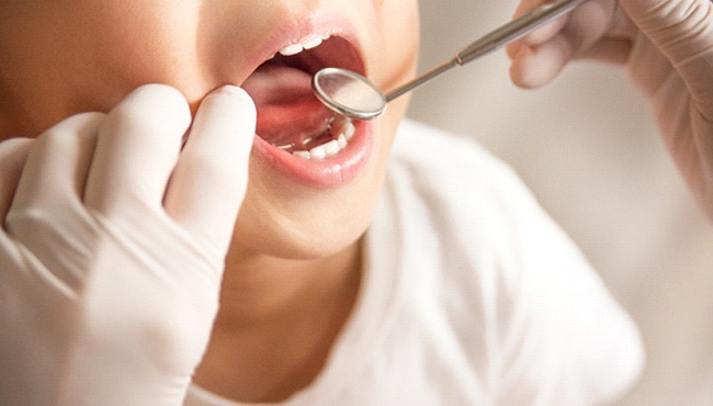Dentists checks for cavities in kids in Buffalo Grove