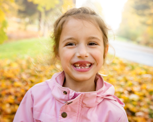young girl missing both front teeth