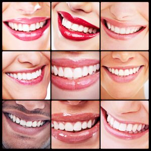 Yellowed teeth detract from your appearance. Buffalo Grove dentist, Dr. Natalya Nagornaya, offers Opalescence teeth whitening to create dazzling smiles.