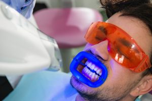 Man receiving professional teeth whitening