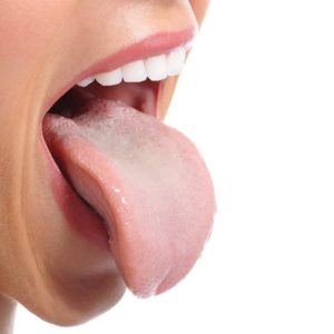Woman sticking out tongue with oral bacteria in Buffalo Grove.